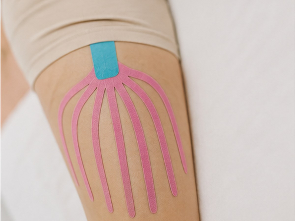 Lymphtaping